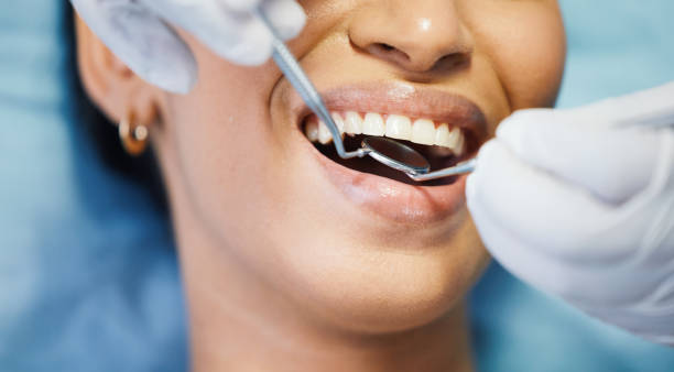 Best Emergency Tooth Extraction in Fraser, MI